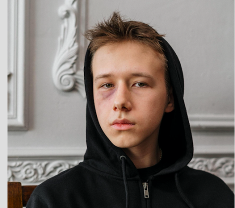 Jugendlicher mit Verletzung im Gesicht