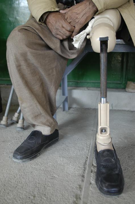 Eine Mann der sein Bein bei einer Landminenexplosion verloren hat und nun eine Prothese trägt