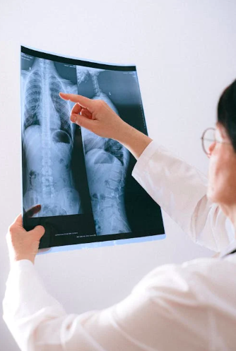 &Auml;rztin mit R&ouml;ntgenbild